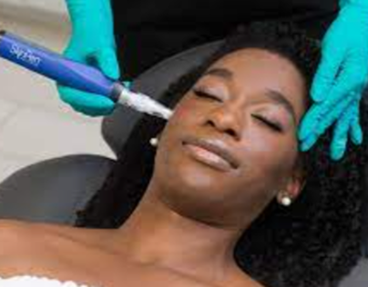 Laser Hair Reduction: Unveiling Smooth Perfection