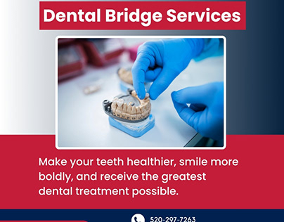 Best Dental Bridges Service in Tucson, AZ