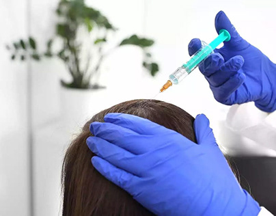 PRP - Most Effective Hair Regrowth Treatment