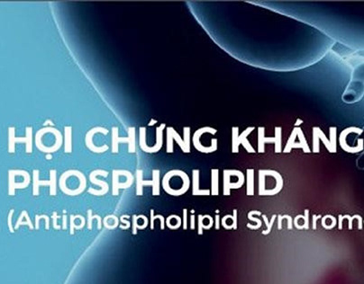 Hội chứng kháng Phospholipid là gì?