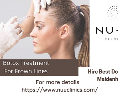 Botox For Crows Feet | NU-U Clinics