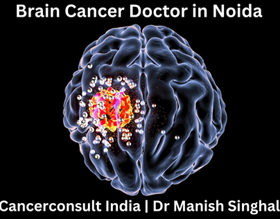 Brain Cancer doctor In Noida
