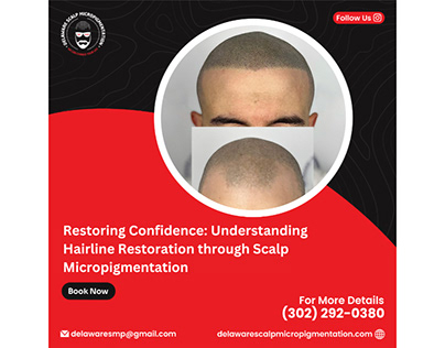 Hairline Restoration Scalp Micropigmentation