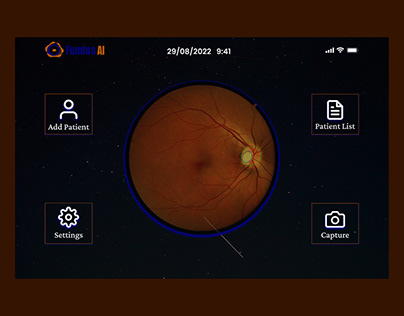 Project thumbnail - Diabetic Retinopathy System