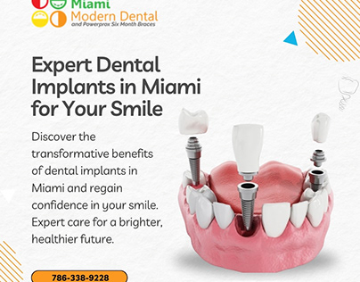 Revitalize Your Smile with top dental Implants in Miami