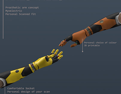 Myoelectric arm prosthetic concept