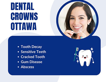 Dental Crowns in Ottawa