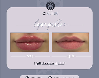 Qi Clinic Before & After post بوست قبل و بعد