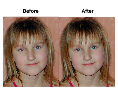 Redeye Removal With Photoshop