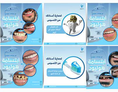 تصميم منشورات انستقرام لعيادات اسنان