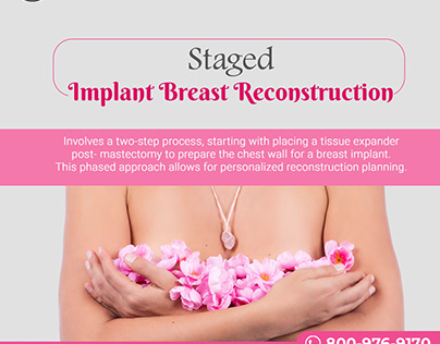 Staged Implant Breast Reconstruction