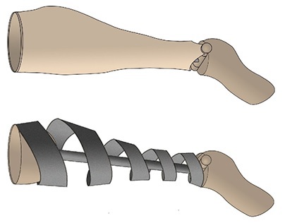 Lower Leg Prosthesis Design Brief