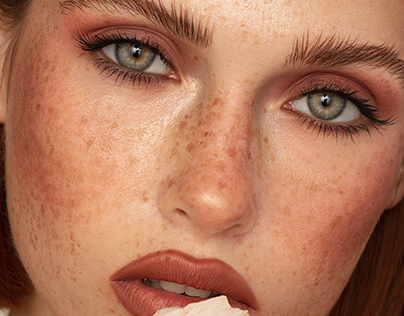Freckle beauty