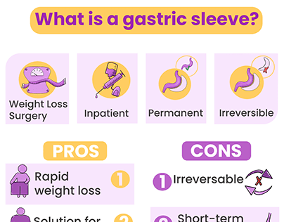 What is a gastric sleeve