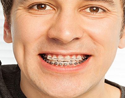 Denture Clinic Calgary | Dentures Repair in SE Calgary