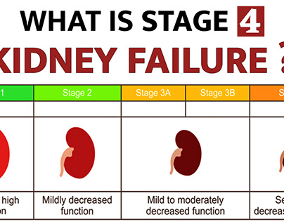 What is Stage 4 Kidney Failure