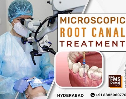 Project thumbnail - Microscopic Root Canal Treatment