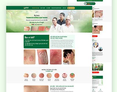 Psoriasis Skin Landing page Design