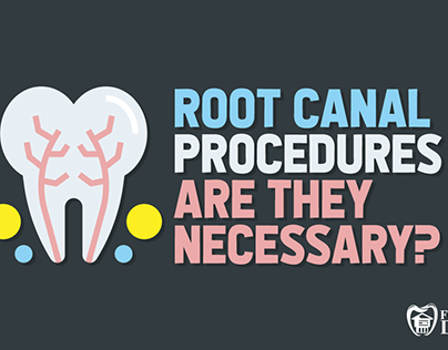 Root Canal Procedures — Are They Necessary?
