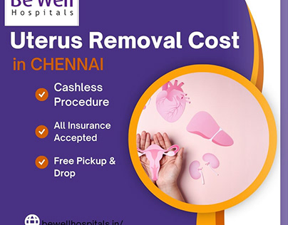 Uterus Removal Cost in Chennai