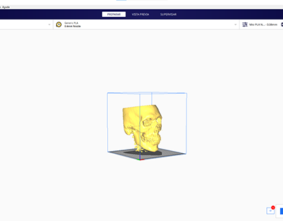Project thumbnail - Impresión 3D a partir de Tomografía (TAC/CT)