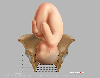 Pelvis anatomy and birth measurements