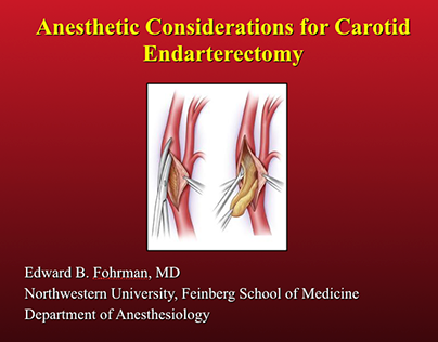 Anesthetic Considerations | Edward Fohrman
