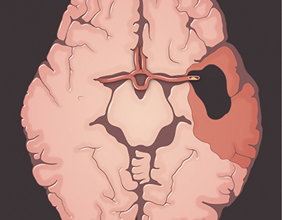 Illustrations of the Human Brain