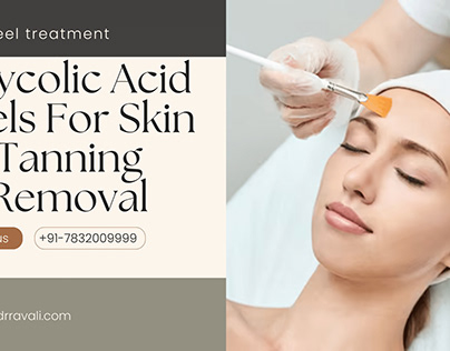 Chemical Peel Treatment for skin rejuvenation