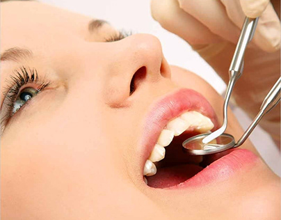 Nguy cơ hỏng cả hàm răng vì lười nhổ răng khôn mọc lệch