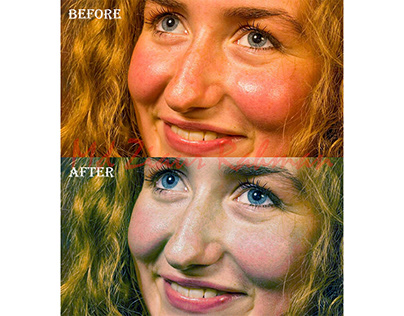 Skin tone color correction