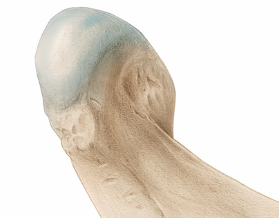 Condyle temporomandibular joint