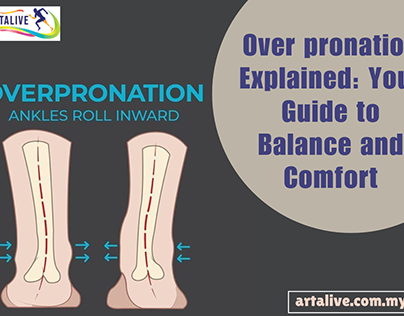 Over pronation Explained: Your Guide to Balance.