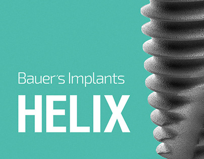 Bauer’s Implants - HELIX Implant