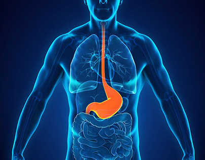 WHAT IS ACID REFLUX? CAUSES AND TREATMENT