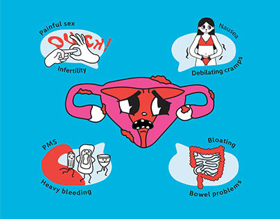 Endometriosis Awareness #endendostigma