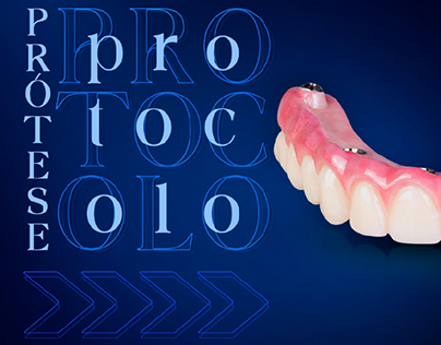 Post Prótese Protocolo p/ clínica Oral Center