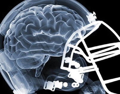 A helmet to protect brains from CTE