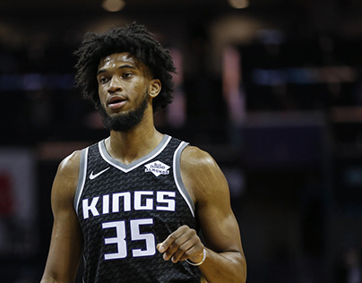 Bagley suffers fracture in left hand