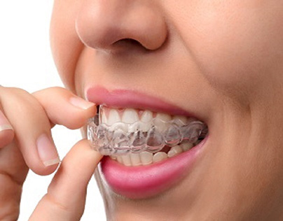 teeth braces can be a positive impact on your life?