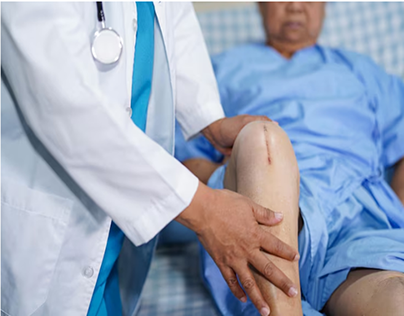 Expert Total Knee Replacement Surgeon in Noida