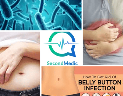 Belly button infection