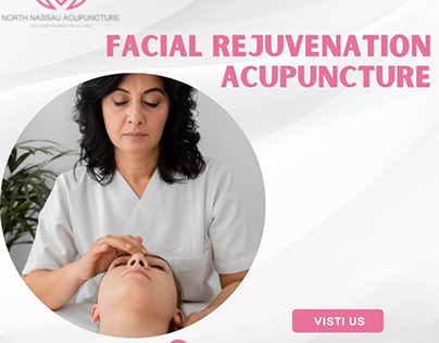Radiant Skin: Facial Rejuvenation Acupuncture