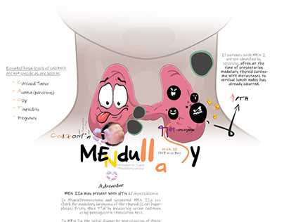 Medullary Carcinoma