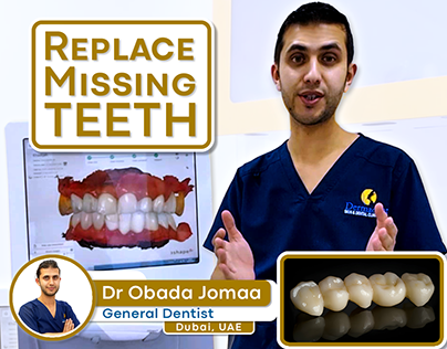 Replace Missing Teeth