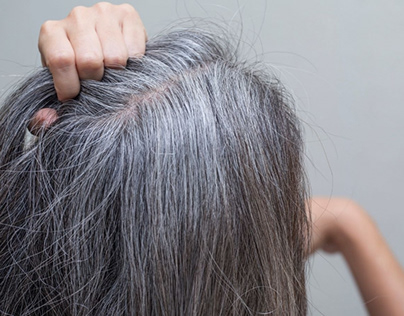 Premature Greying of Hairs