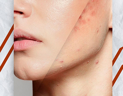 Photo retouching/work with skin defects