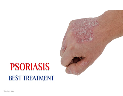 Homeopathy treatment for psoriasis