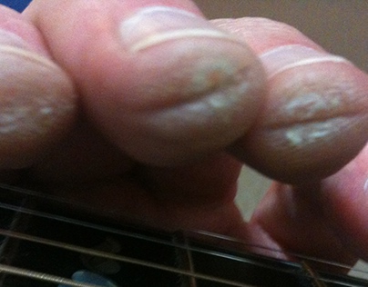 Tips for Building Guitar Calluses