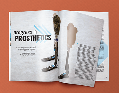 Progress in Prosthetics